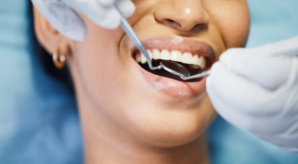 Best Broken Tooth Emergency  in Martinez, GA