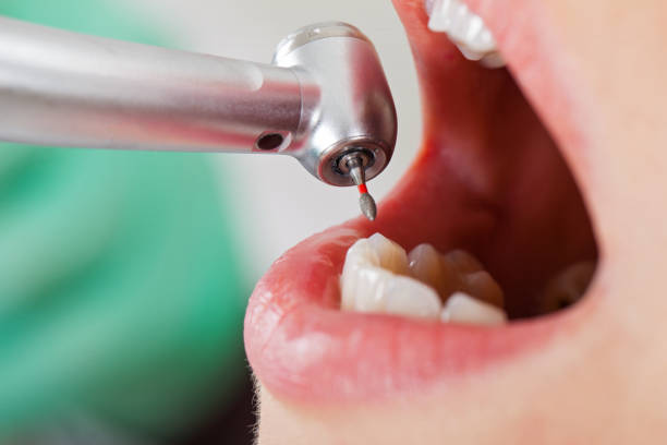 Best Emergency Gum Pain Relief  in Martinez, GA